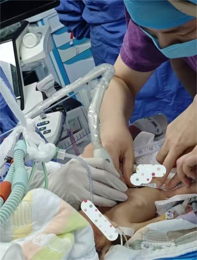 为1540克早产宝宝打通 “生命之桥”！我院首例新生儿PICC置管成功